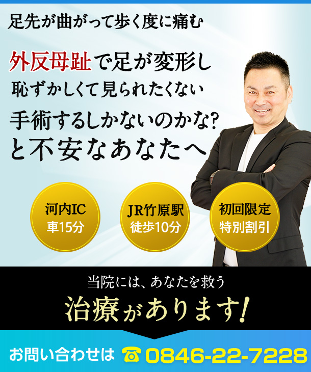 外反母趾で足が変形し恥ずかしくて見られたくない。手術するしかないのかな？と不安なあなたへ